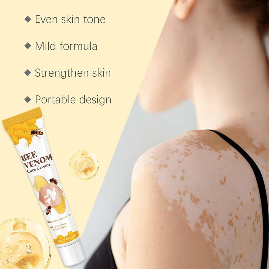 Vitigo Bee Venom Treatment Cream | Natural Skin Repair Hydration Relief Anti-Irritation